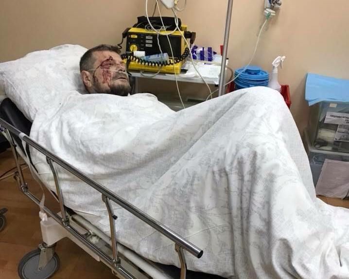Депутат Ігор Мосійчук поранений після вибуху авто у Києві (фото)