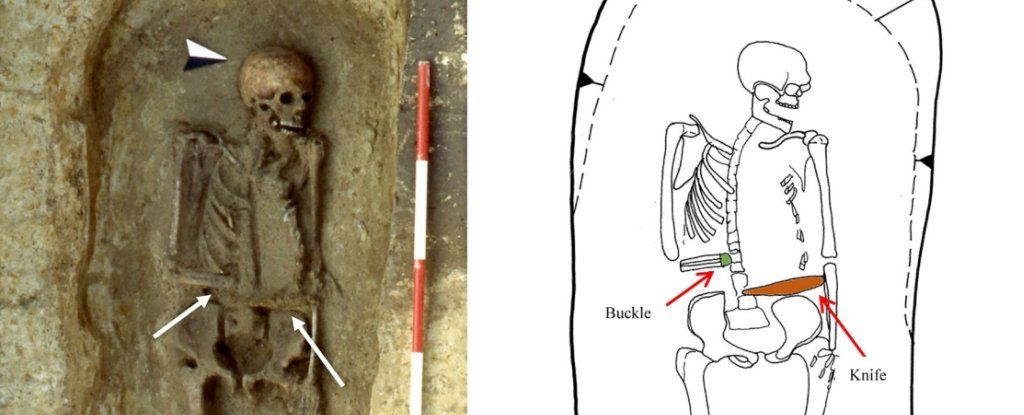 В Італії археологи розкопали останки чоловіка VI-VIII століть із протезом-ножем